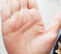 女人纹路：手上纹路多且杂乱代表什么