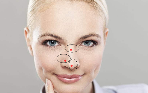 女人鼻子有痣代表什么，鼻子有痣的女人好吗